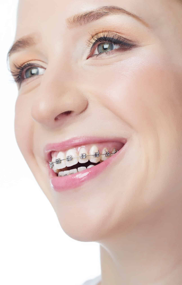 Best Orthodontics Near Me- Bankstown Orthodontics